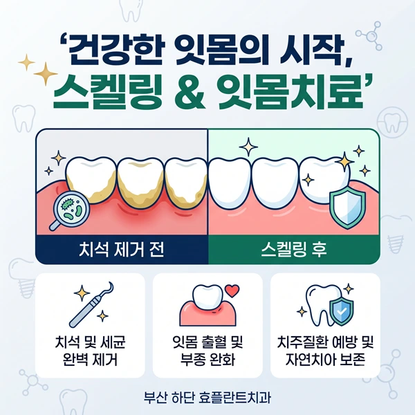 양치할 때 피가 난다면? 하단·명지 덜 아픈 3단계 무통마취 잇몸치료