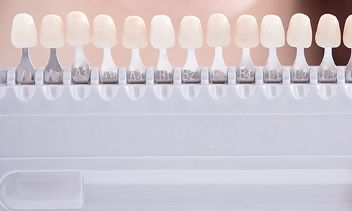 원데이 라미네이트 