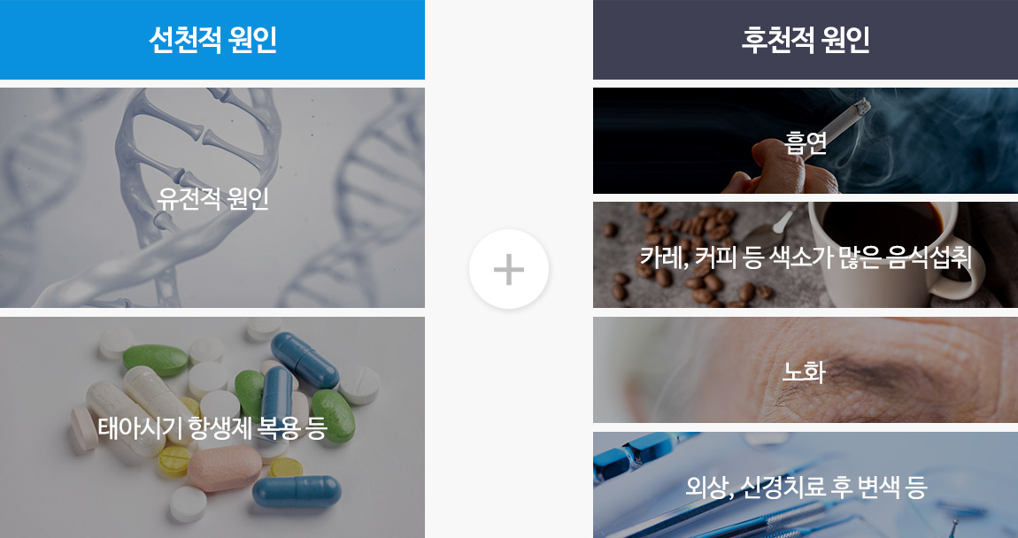 선천적 원인(유전적 원인, 태아시기 항생제 복용 등) + 후천적 원인(흡연 + 카레, 커피 등 색소가 많은 음식 섭취 + 노화 + 외상, 신경치료 후 변색 등)